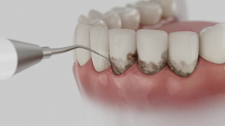 Reliable Dental contractor in Holtville, CA by Smile Center Dentistry